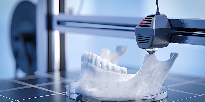 3D-Druck Technologie